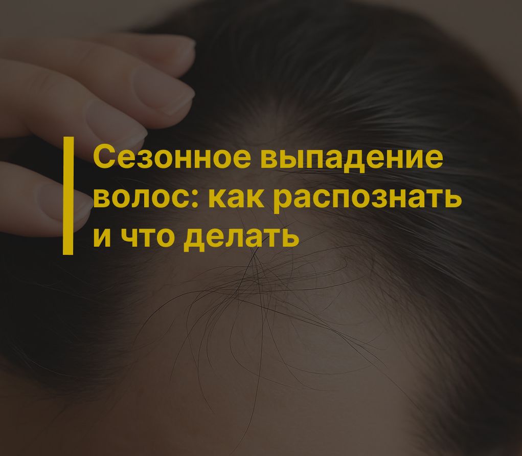  Сезонное выпадение волос: как распознать и что делать