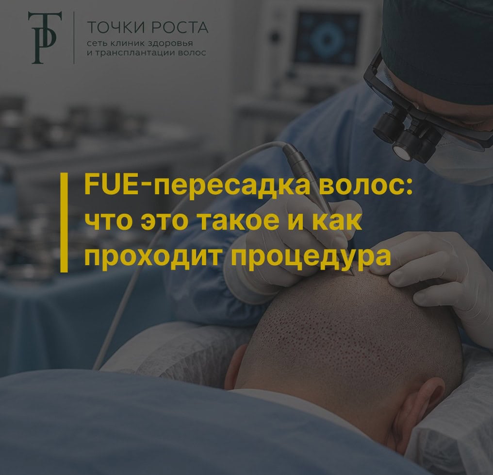FUE-пересадка волос: что это такое и как проходит процедура