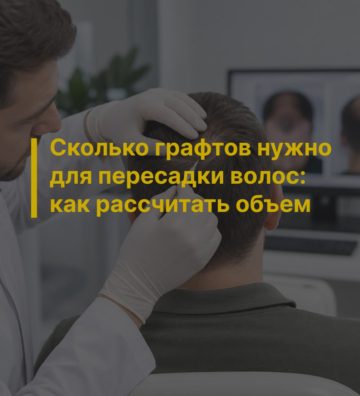 Сколько графтов нужно для пересадки волос: как рассчитать объем