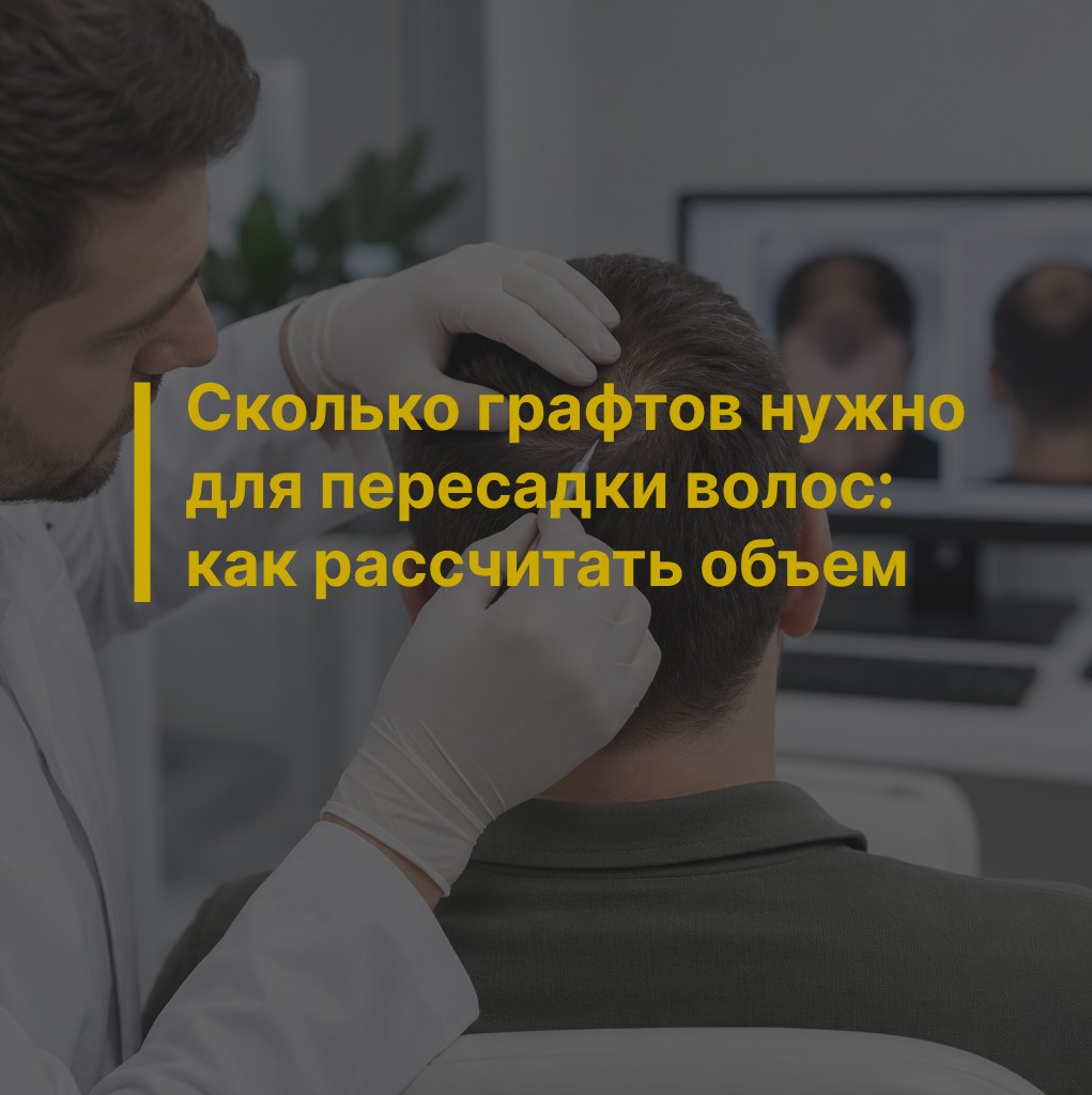 Сколько графтов нужно для пересадки волос: как рассчитать объем
