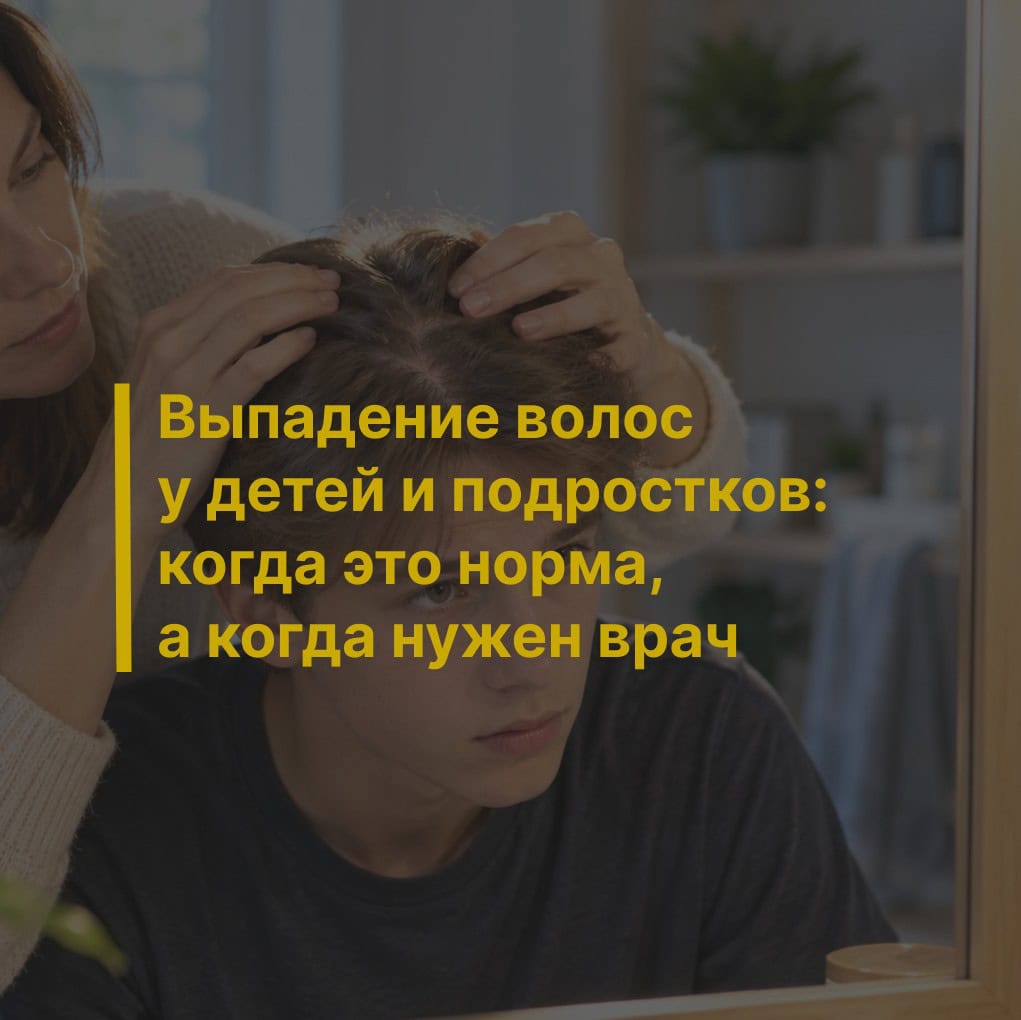 Выпадение волос у детей и подростков: когда это норма, а когда нужен врач