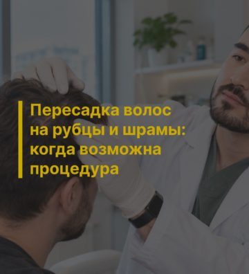 Пересадка волос на рубцы и шрамы: когда возможна процедура