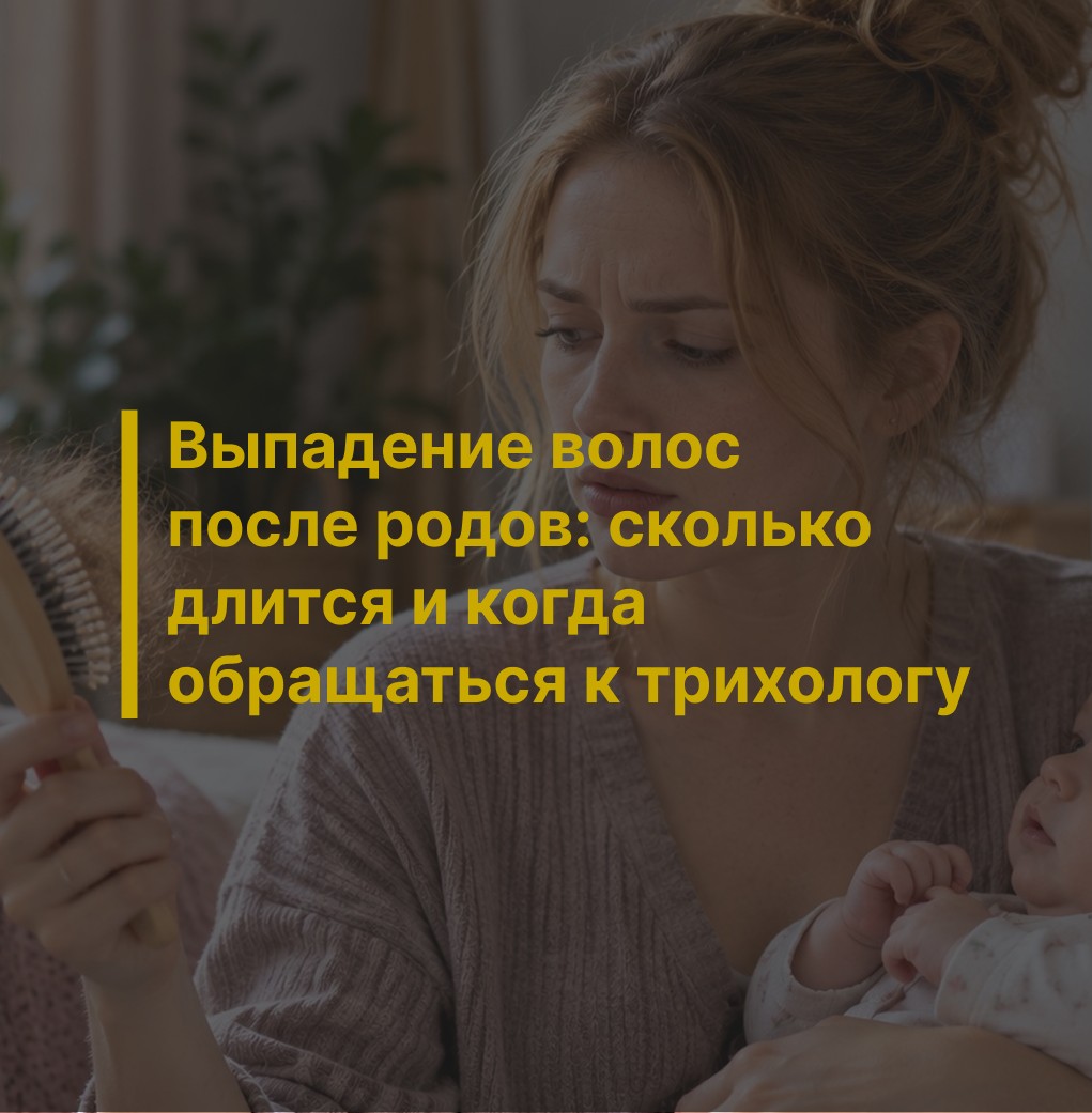 Выпадение волос после родов: сколько длится и когда обращаться к трихологу